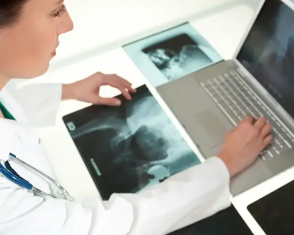 Breast Cancer Detection Case Study Illustration